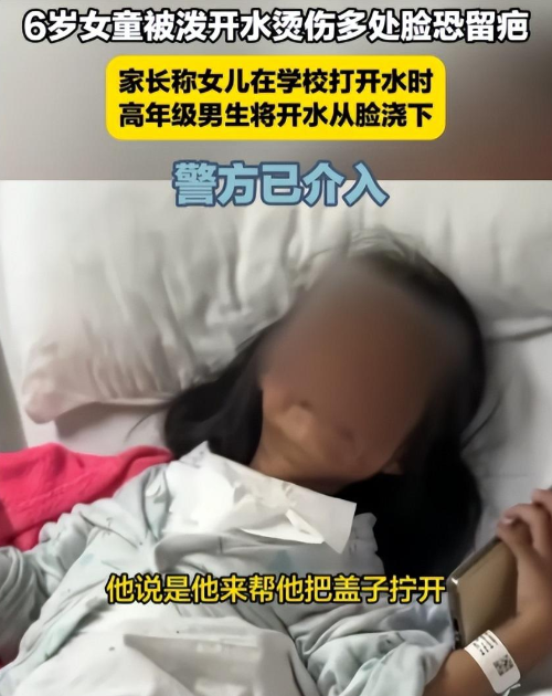 痛心！广东6岁女童校园内被开水严重烫伤，学校和教育局回应遭质疑