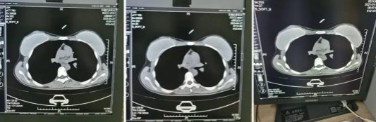 曝光！无锡虹桥医院被指骗保，医保局全面排查(图2)